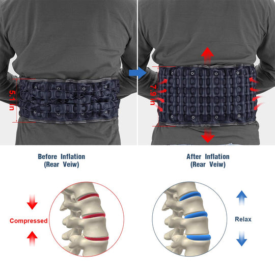 HONGJING Decompression Back Belt | Lumbar Support for Back Pain Relief